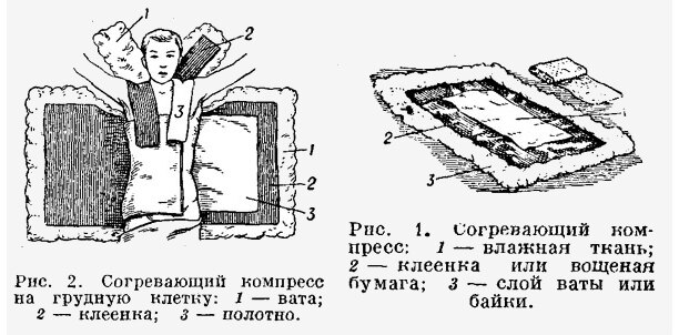 Схема согревающего компресса